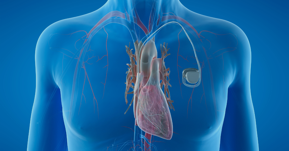 biocompatible pacemaker