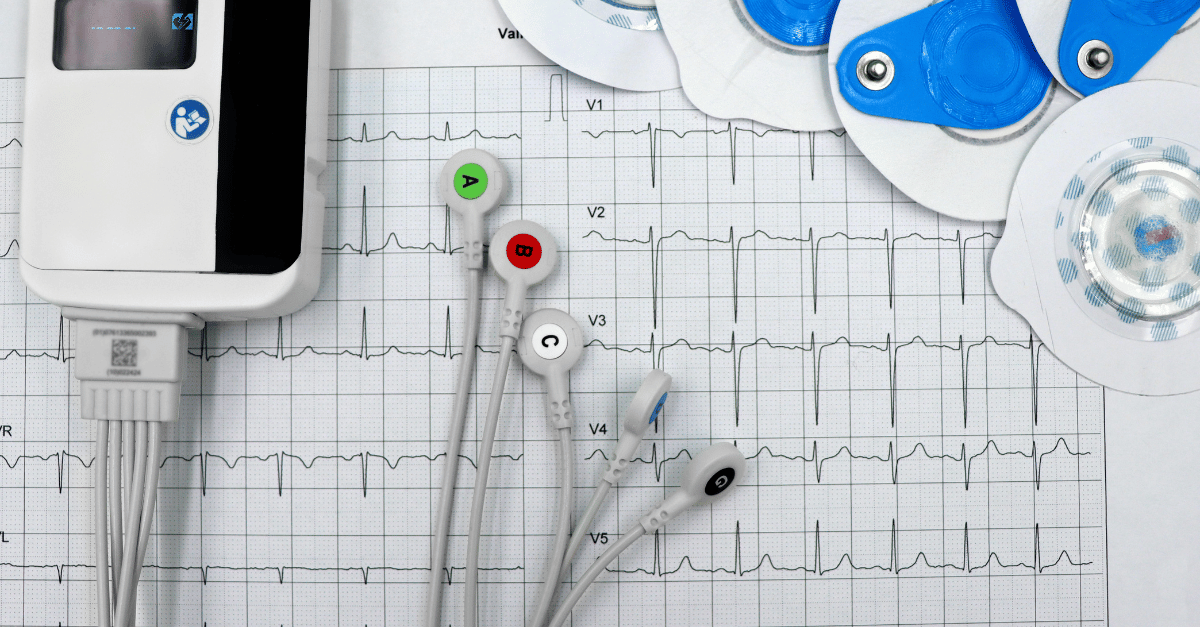ecg monitor and leads